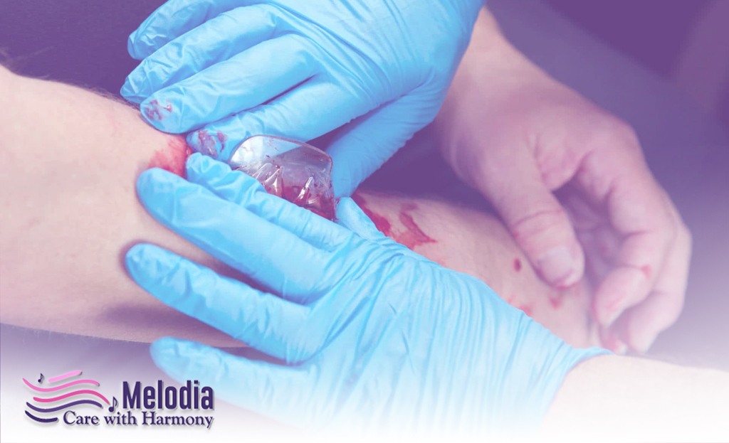 Prevent An Excessive Loss Of Blood Hospice Death Kit Melodiacare.com Prevent An Excessive Loss Of Blood